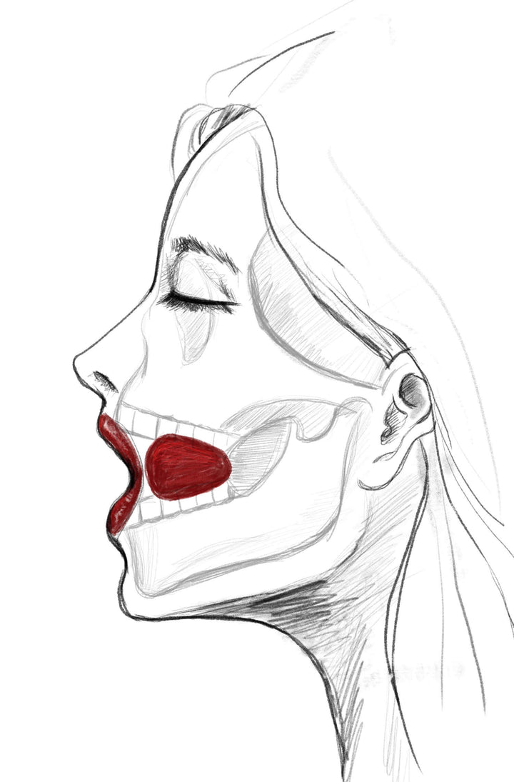 UPKO mouth gag